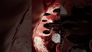 What Do Blood Clots Look Like and How Are They Formed [upl. by Auqinaj]