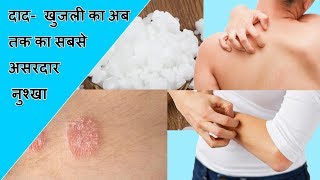 Skin Infection Remedies  Fungal infection treatment in hindi  Home remedies for skin infection [upl. by Yobybab]