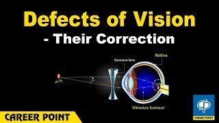 Defects of Vision and Their Correction Myopia And Hypermetropia [upl. by Florenza]