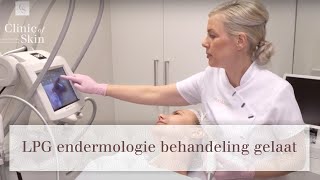 LPG endermologie behandeling gelaat [upl. by Ecerehs]