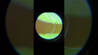 Hidden Wonders of a Terrarium under a Microscope shorts [upl. by Aiym]