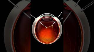 How is vitrectomy done Vitrectomy can change your life if you have diabetic retinopathy [upl. by Omrellug]