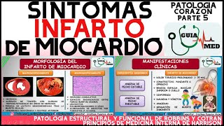 QUÉ ES UN INFARTO AGUDO AL MIOCARDIO SIGNOS Y SÍNTOMAS  GuiaMed [upl. by Ecitnirp]