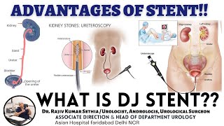 ADVANTAGES of DJ STENT  What is DJ STENT  How to remove STENT   Dr Rajiv Kumar Sethia [upl. by Luna394]