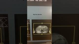 MRI Abdomen Exam diagnosticradiology radiology science mri mrimachine mritech [upl. by Trout289]