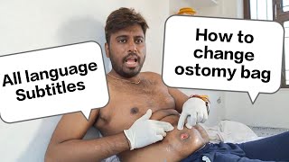 How to change ostomy bag nursing  Changing an ostomy bag  How to change Colostomy bag [upl. by Gabler]