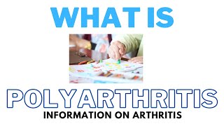 What Is Polyarthritis  The Cause The Symptoms amp The Diagnosis [upl. by Daphene]