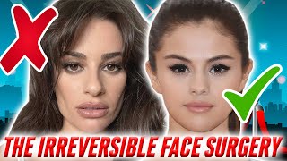 The Truth Behind Buccal Fat Removal FAILS vs Successes Using Celebrity Examples [upl. by Ettena697]