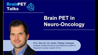 Dr Lohmann Neuro Oncology [upl. by Eetnod]