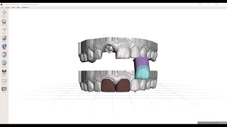 Mirroring a Central Incisor in Meshmixer [upl. by Assirat422]