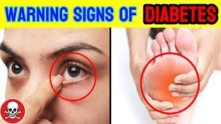 9 Hidden Signs of Diabetes That You May Discover Before Its Too Late [upl. by Andromache]