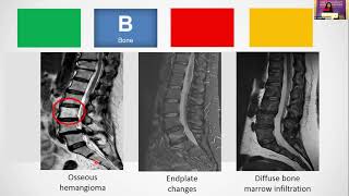 Interpreting MRI of the spine As simple as ABCD [upl. by Jewelle741]