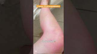 EU CAMARÃO NA PRAIA skelt autobronzeador verão bronze dicasdepele dicasdebeleza [upl. by Akapol244]