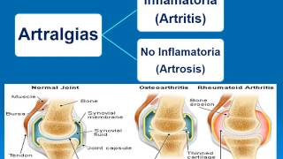 Semiologia Osteoarticular Dr Angel Granado [upl. by Ydnak604]