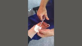 Instruction on how to use our 5mm Felt Chiropody Padding [upl. by Calder]