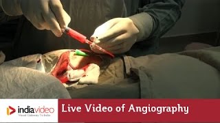 Live Video of Angiography at Lisie Hospital  How angiography is done [upl. by Ameyn736]