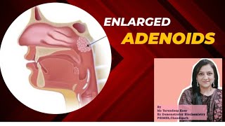 What are Adenoids Causes amp Symptoms of Enlarged AdenoidsAdenoiditis [upl. by Enilecram]