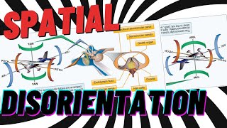 Escaping Spatial Disorientation My Friends Tragic Story [upl. by Winslow]
