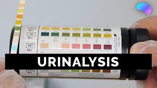 Urinalysis  OSCE Guide old version  UKMLA  CPSA [upl. by Cristin199]