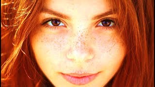 Scientists Say That Red Haired People Have These Genetic Superpowers [upl. by Noxas]