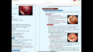 Acute and chronic suppurative otitis media [upl. by Andre]