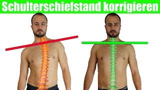 Schulterschiefstand beheben  Krumme Wirbelsäule  Brustkorb aufrichten [upl. by Hagan]