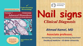 Nail signs Clinical Diagnosis of Skin Diseases [upl. by Racklin]