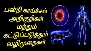 Pandri Kaichal Arikuri  Pandri Kaichal Symptoms  Pandri Kaichal Treatment  Health Tips Tamil [upl. by Aicilaanna926]