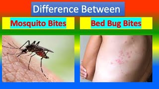 Difference Between Mosquito Bites and Bed Bug Bites [upl. by Enimsay]