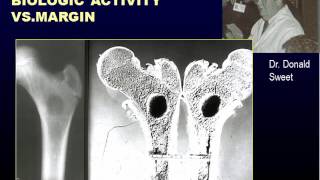 Radiographic Approach to Bone Lesions Part I [upl. by Dagney]