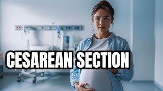 What You NEED To Know About CSections [upl. by Nirmak]