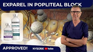 Popliteal block Exparel®s GameChanging FDA Approval [upl. by Settera]