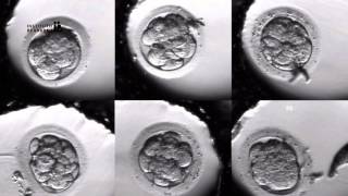 IVF PROCESS STEP BY STEP In Vitro Fertilisation Embryo cultivation [upl. by Anitnas]