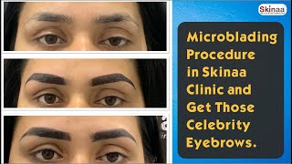 Microblading Procedure in Skinaa Clinic [upl. by Mccarthy981]