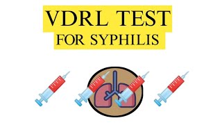 VDRL test  VDRL test for syphilis Venereal Disease Research Laboratory Test [upl. by Ralleigh]