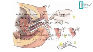 STDs Overview [upl. by Wurst]