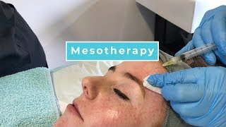 Mesotherapy With Anna [upl. by Ahsekat]