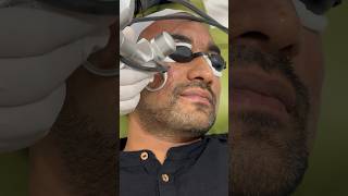 Best Laser treatment for your face [upl. by Radack420]