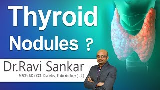 Thyroid Nodules  What are Thyroid nodules  DrRavi Sankar  Endocrinologist  Hi9 [upl. by Enidaj]