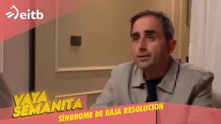 VS Síndrome de baja resolución vayasemanita [upl. by Seleta]