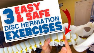 3 EASY amp SAFE L5S1 Disc Herniation Exercises amp L4L5  Dr Marc Dupuis Chiropractor in Sanford ME [upl. by Zetnwahs847]