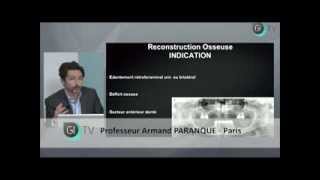 Aménagement des volumes osseux à but implantaire des cas simples aux cas complexes [upl. by Assiral]