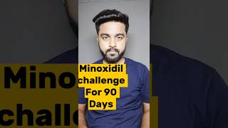 Minoxidil Challenge For 90 Days Day34  minoxidilresult minoxidil viralreels viralshorts hair [upl. by Adele]