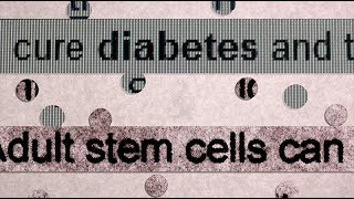 Diabetes and Stem Cells [upl. by Zaneta401]