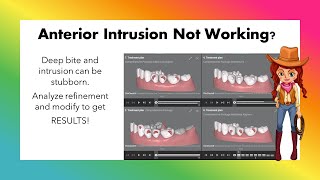 Invisalign ClinCheck  Anterior Intrusion Refinement additional aligners [upl. by Eenyaj]