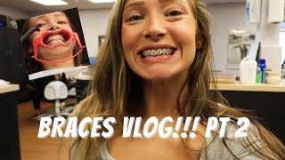 GETTING BRACES ON VLOG 2023 [upl. by Lanahtan]