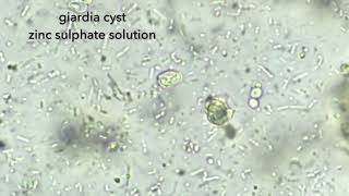 Giardia cyst in fecal floatation [upl. by Vieva]