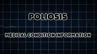 Poliosis Medical Condition [upl. by Adolph940]