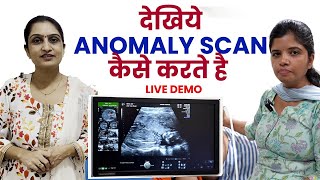 Anomaly scan in pregnancy Dr Asha Gavade [upl. by Lirva489]