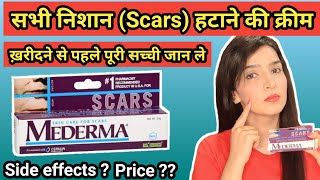 Mederma cream  mederma for acne scars  mederma advanced scar gel review [upl. by Dajma306]